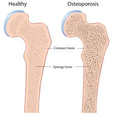 strength training workouts bone health